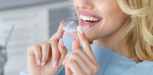 Invisalign Burnaby